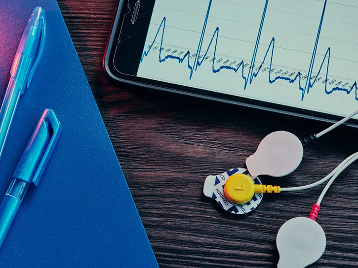 An Android app for ECG data and electrodes for ECG recording.