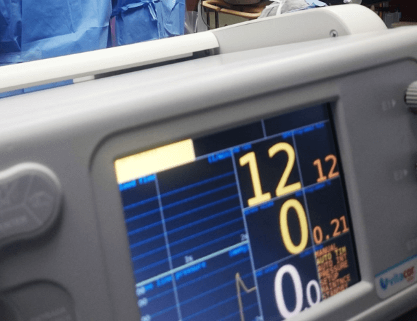 A cardiac trigger monitor connected to sensors.