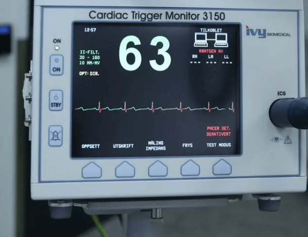 The control panel of a medical electronic system with a screen on it