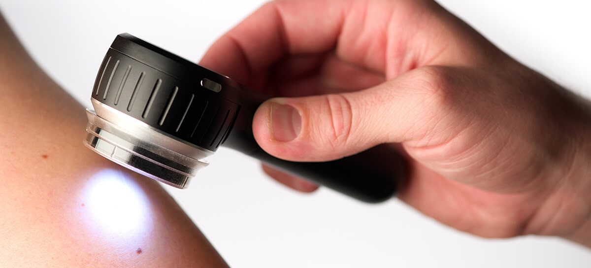 Portable dermatoscope for skin diagnostics