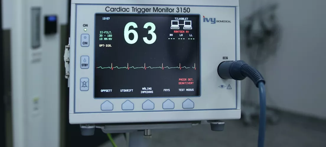 A cardiac trigger monitor connected to sensors.