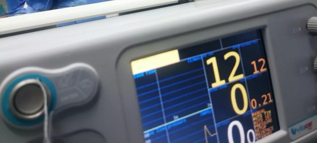 The control panel of a medical electronic system with a screen on it